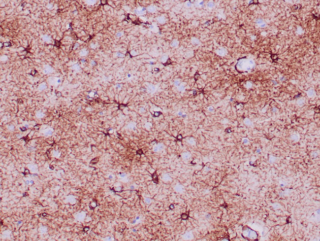 GFAP Antibody in Immunohistochemistry (Paraffin) (IHC (P))