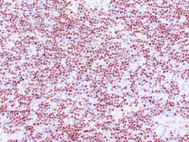 TdT Antibody in Immunohistochemistry (Paraffin) (IHC (P))