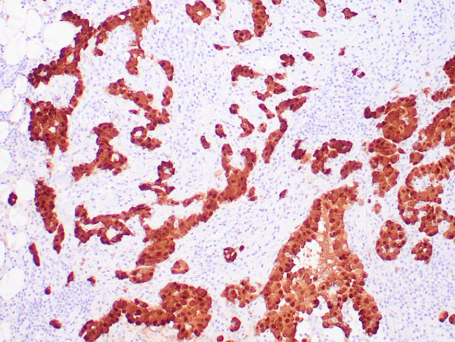 Calretinin Antibody in Immunohistochemistry (Paraffin) (IHC (P))