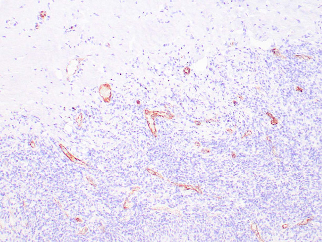 Factor VIII-R Ag Antibody in Immunohistochemistry (Paraffin) (IHC (P))