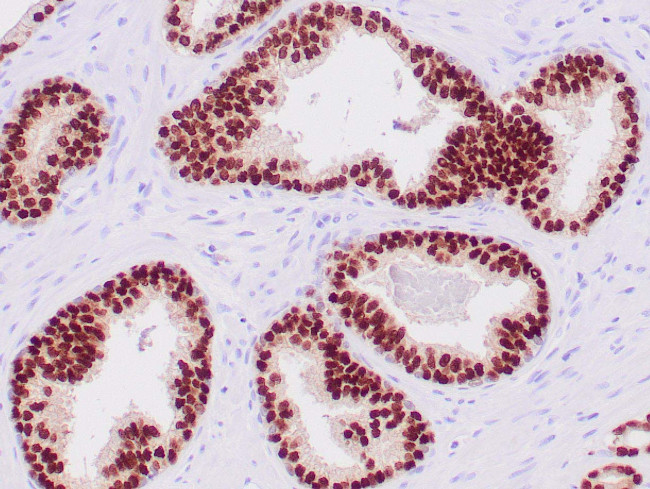 NKX3.1 Antibody in Immunohistochemistry (Paraffin) (IHC (P))