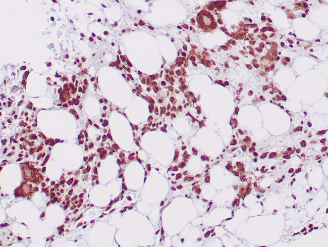 Nucleophosmin Antibody in Immunohistochemistry (Paraffin) (IHC (P))
