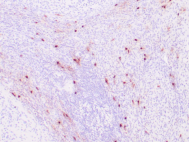 Tryptase Antibody in Immunohistochemistry (Paraffin) (IHC (P))