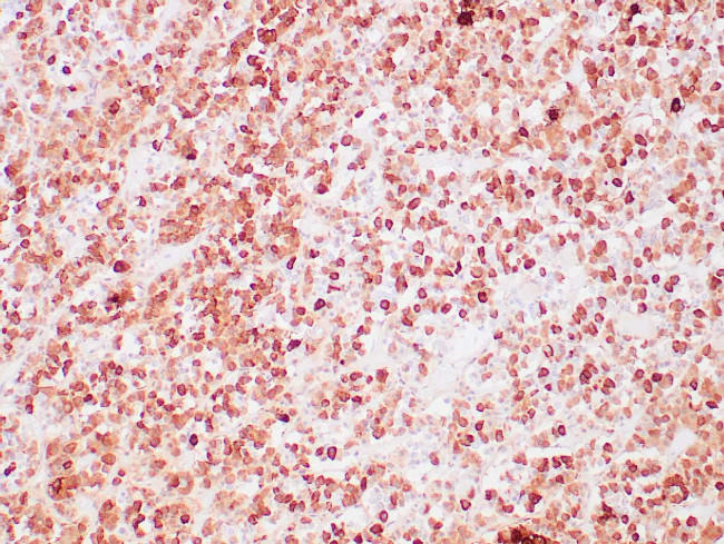 ACTH Antibody in Immunohistochemistry (Paraffin) (IHC (P))