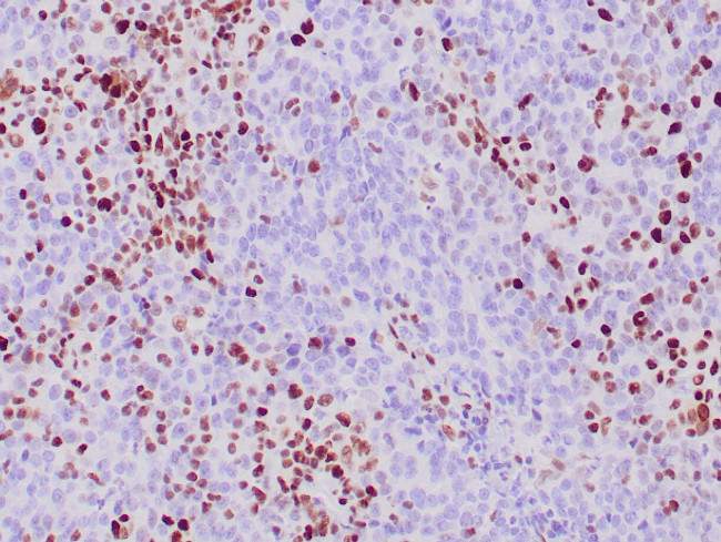MSH-6 Antibody in Immunohistochemistry (Paraffin) (IHC (P))