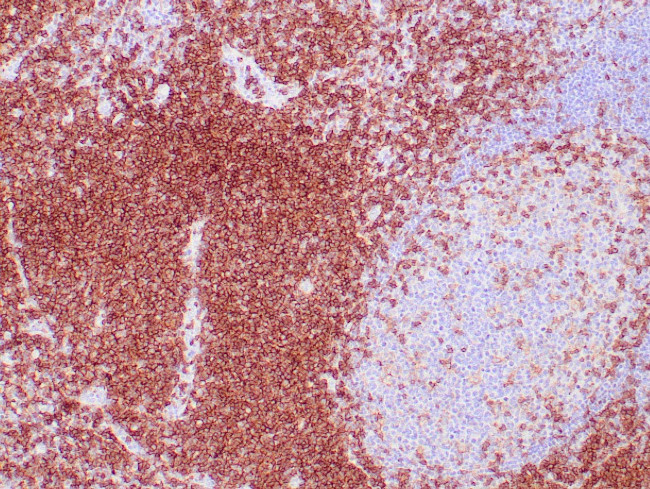 CD4 Antibody in Immunohistochemistry (Paraffin) (IHC (P))