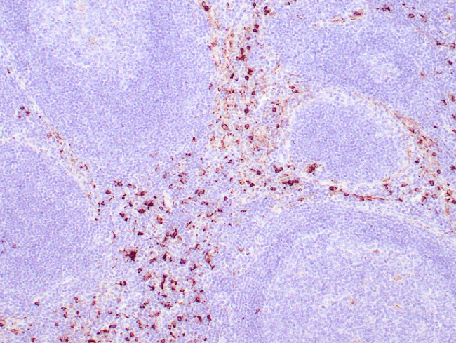 Lysozyme Antibody in Immunohistochemistry (Paraffin) (IHC (P))