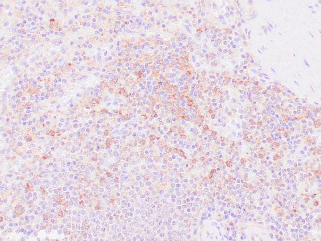 CD33 Antibody in Immunohistochemistry (Paraffin) (IHC (P))