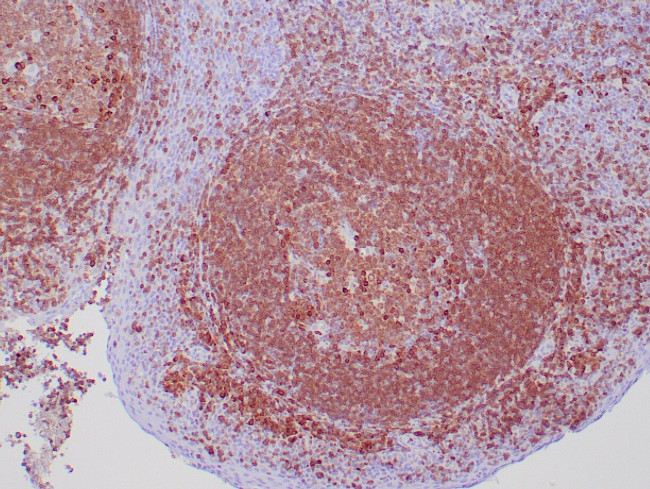 CD79a Antibody in Immunohistochemistry (Paraffin) (IHC (P))