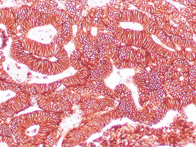 EP-CAM Antibody in Immunohistochemistry (Paraffin) (IHC (P))