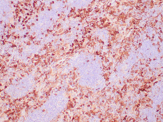 Fascin Antibody in Immunohistochemistry (Paraffin) (IHC (P))