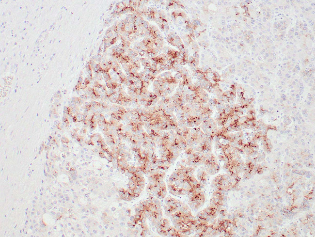 Glypican 3 Antibody in Immunohistochemistry (Paraffin) (IHC (P))