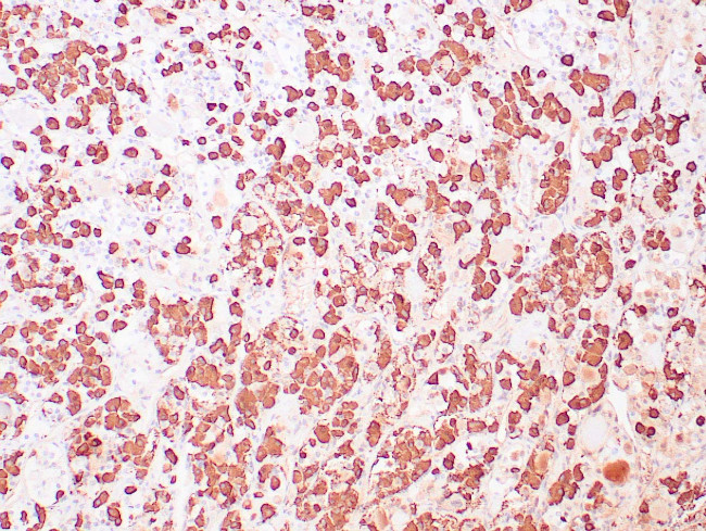 Growth Hormone Antibody in Immunohistochemistry (Paraffin) (IHC (P))