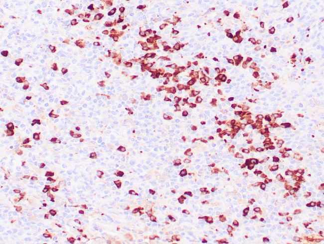 Lambda Antibody in Immunohistochemistry (Paraffin) (IHC (P))