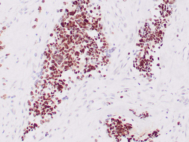 Myogenin Antibody in Immunohistochemistry (Paraffin) (IHC (P))