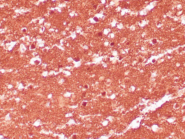 PGP9.5 Antibody in Immunohistochemistry (Paraffin) (IHC (P))