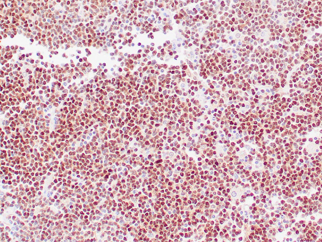 Cyclin D1 Antibody in Immunohistochemistry (Paraffin) (IHC (P))