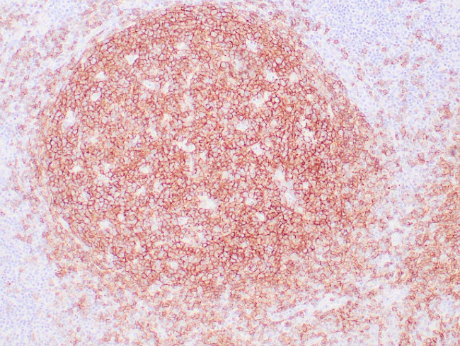 CD19 Antibody in Immunohistochemistry (Paraffin) (IHC (P))