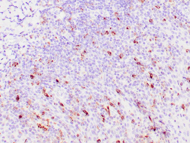 TRAcP Antibody in Immunohistochemistry (Paraffin) (IHC (P))