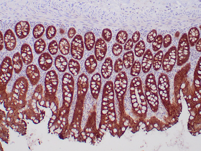 Villin Antibody in Immunohistochemistry (Paraffin) (IHC (P))