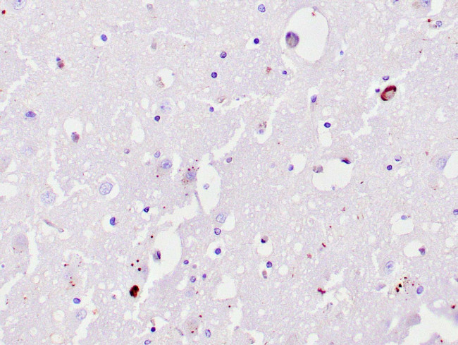 Ubiquitin Antibody in Immunohistochemistry (Paraffin) (IHC (P))