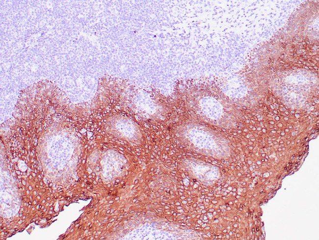 Cytokeratin 5 Antibody in Immunohistochemistry (Paraffin) (IHC (P))