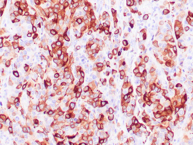 Mammaglobin A Antibody in Immunohistochemistry (Paraffin) (IHC (P))