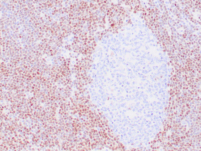 Cyclin D1 Antibody in Immunohistochemistry (Paraffin) (IHC (P))