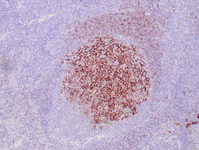 CD23 Antibody in Immunohistochemistry (Paraffin) (IHC (P))