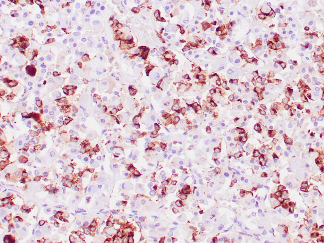 Prolactin Antibody in Immunohistochemistry (Paraffin) (IHC (P))