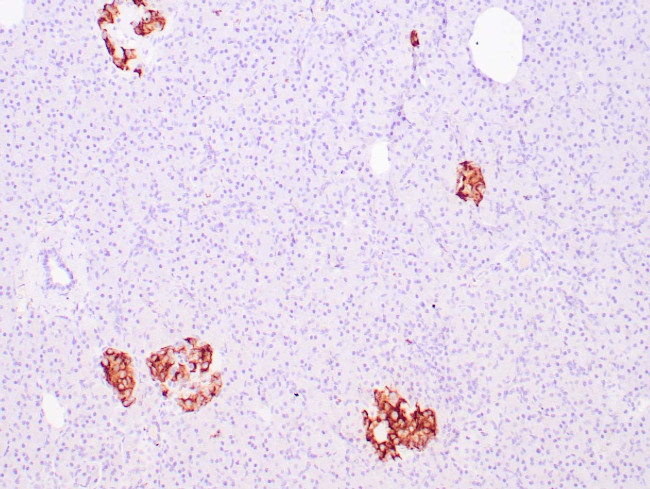 Insulin Antibody in Immunohistochemistry (Paraffin) (IHC (P))