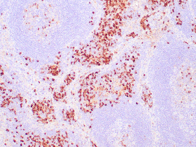 Kappa Antibody in Immunohistochemistry (Paraffin) (IHC (P))