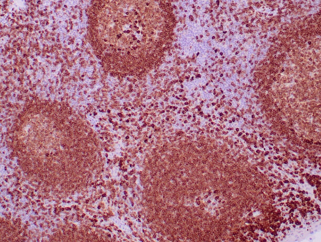 CD79a Antibody in Immunohistochemistry (Paraffin) (IHC (P))