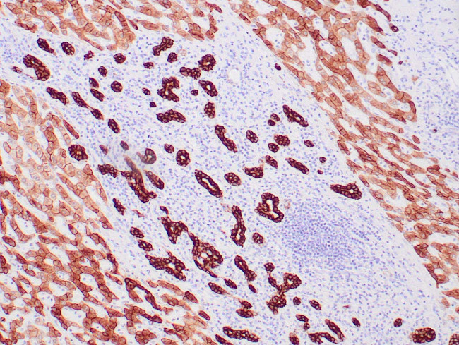 Cytokeratin, Pan Antibody in Immunohistochemistry (Paraffin) (IHC (P))