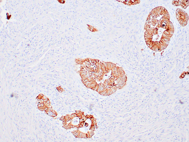 Cytokeratin 18 Antibody in Immunohistochemistry (Paraffin) (IHC (P))