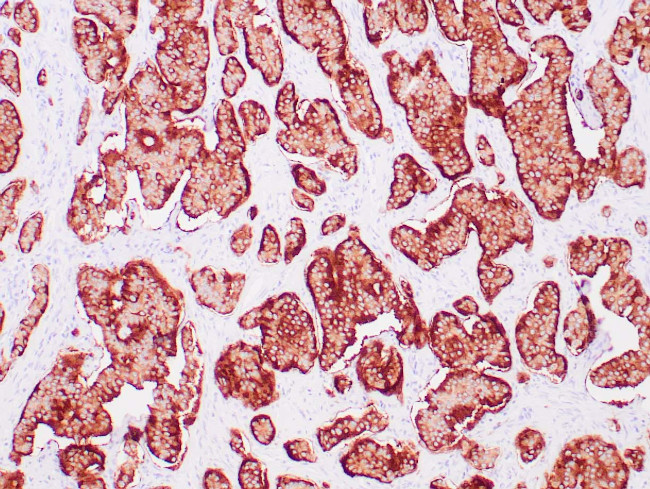 Synaptophysin Antibody in Immunohistochemistry (Paraffin) (IHC (P))