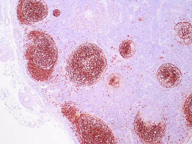CD23 Antibody in Immunohistochemistry (Paraffin) (IHC (P))