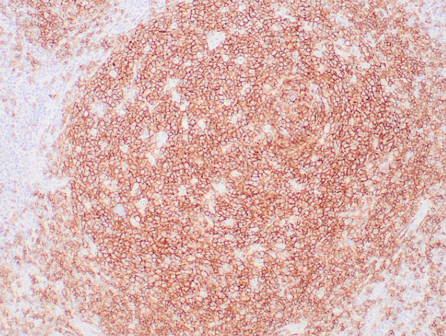 CD19 Antibody in Immunohistochemistry (Paraffin) (IHC (P))