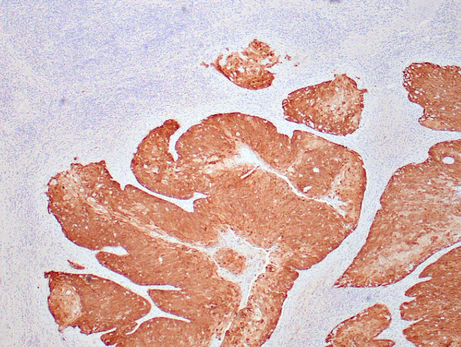 p16INK4a Antibody in Immunohistochemistry (Paraffin) (IHC (P))