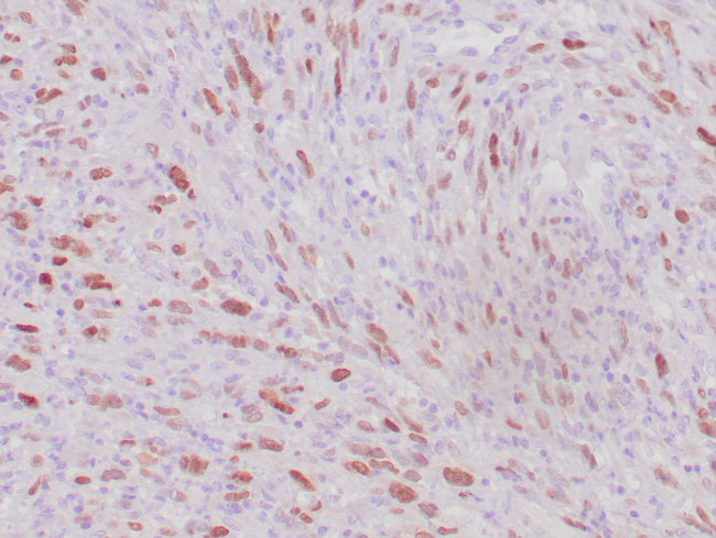 MyoD1 Antibody in Immunohistochemistry (Paraffin) (IHC (P))