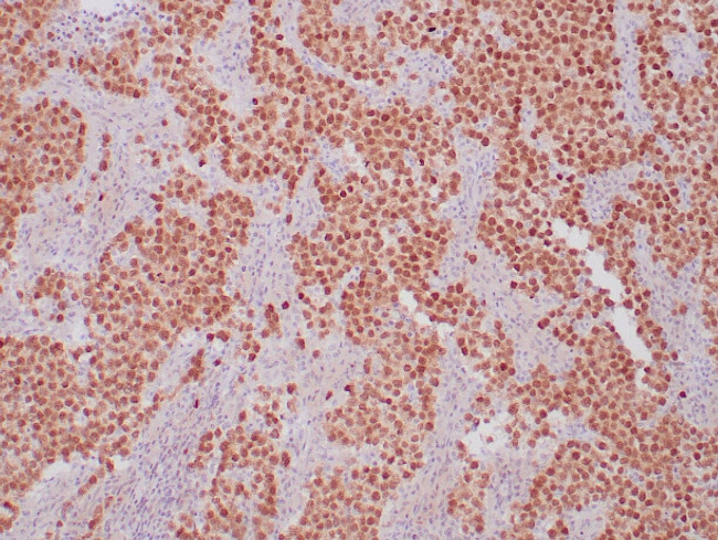 OCT-4 Antibody in Immunohistochemistry (Paraffin) (IHC (P))