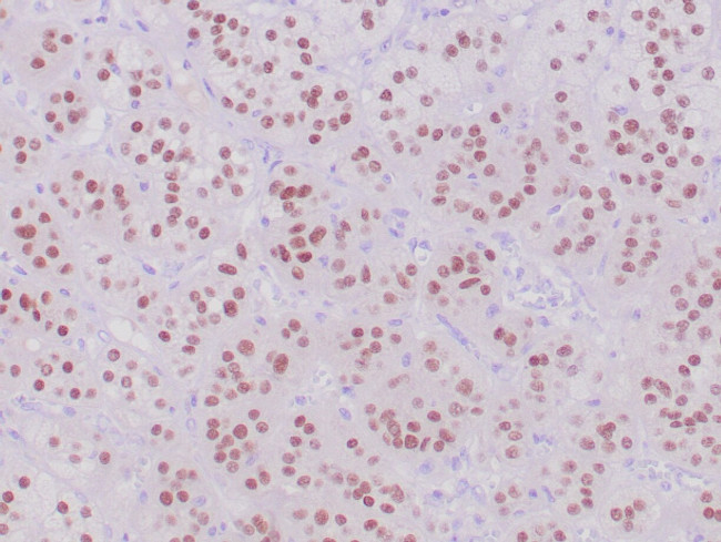 Steroidogenic Factor-1 Antibody in Immunohistochemistry (Paraffin) (IHC (P))