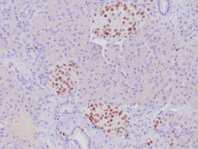 INSM1 Antibody in Immunohistochemistry (Paraffin) (IHC (P))