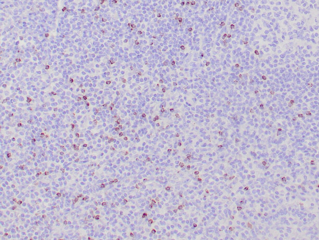 TIA-1 Antibody in Immunohistochemistry (Paraffin) (IHC (P))
