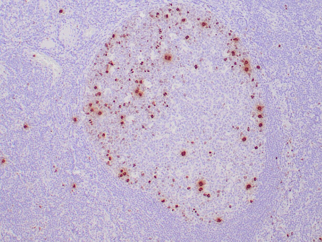 Phospho-Histone H3 (Ser10) Antibody in Immunohistochemistry (Paraffin) (IHC (P))