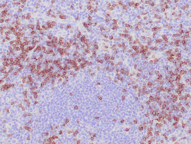 CD8 Antibody in Immunohistochemistry (Paraffin) (IHC (P))