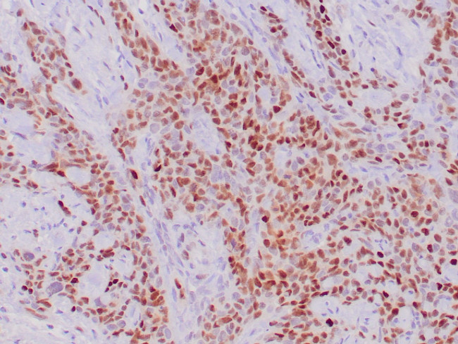 p21 Antibody in Immunohistochemistry (Paraffin) (IHC (P))
