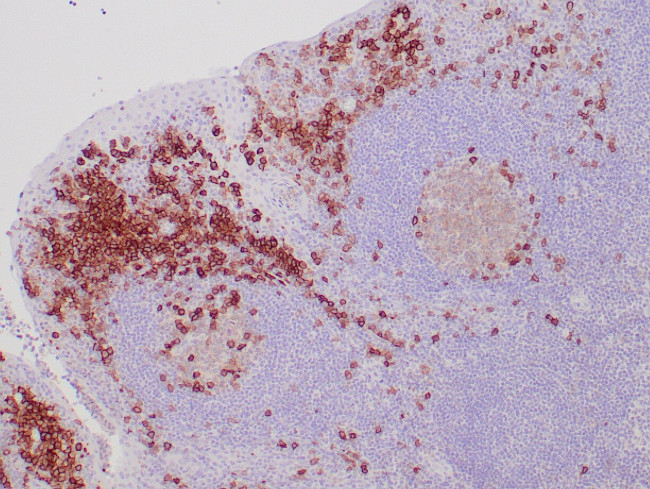 CD38 Antibody in Immunohistochemistry (Paraffin) (IHC (P))