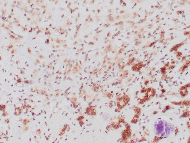 p120 Antibody in Immunohistochemistry (Paraffin) (IHC (P))