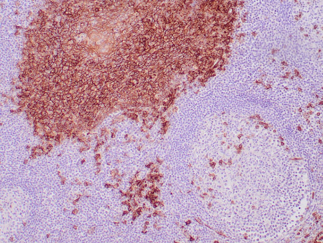 CD138 Antibody in Immunohistochemistry (Paraffin) (IHC (P))
